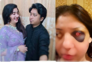 জিগাতলায় গৃহবধূকে মারধর, চোখে গুরুতর আঘাত: দেবর-দেবরের স্ত্রী গ্রেফতার