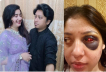 জিগাতলায় গৃহবধূকে মারধর, চোখে গুরুতর আঘাত: দেবর-দেবরের স্ত্রী গ্রেফতার